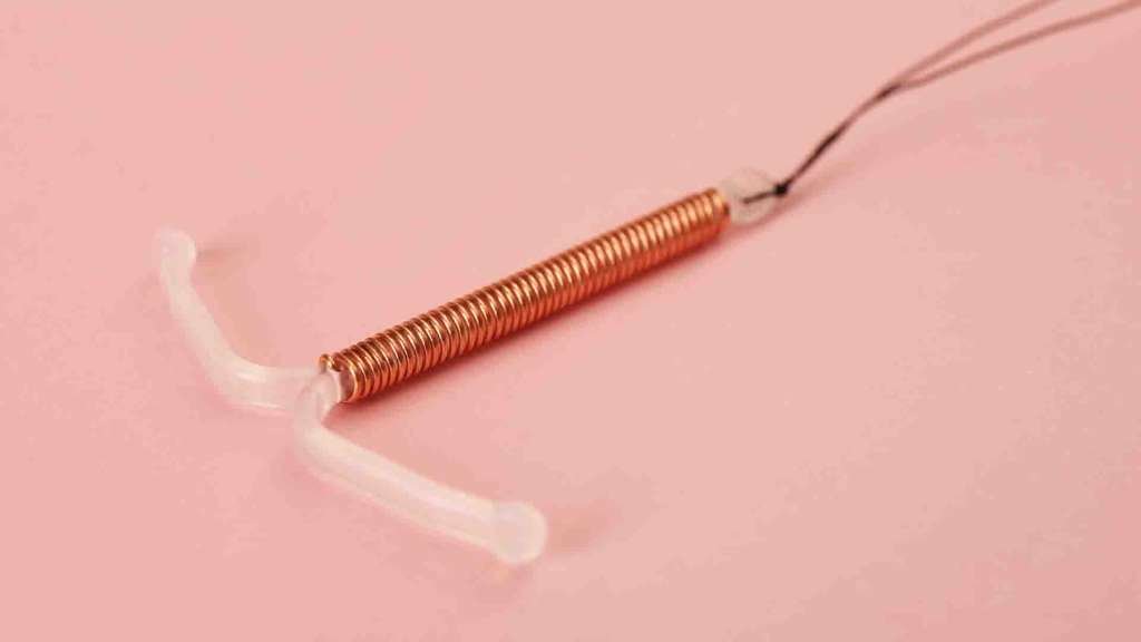 Stérilet en cuivre pour une contraception féminine.